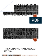 Anomalías de Fusión Mandibular Epidemiologia