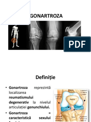 gonartroza gr 1