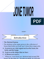 Bone Tumour