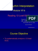 ECG Rhythm Interpretation2 - DR - ISMAYIL PDF