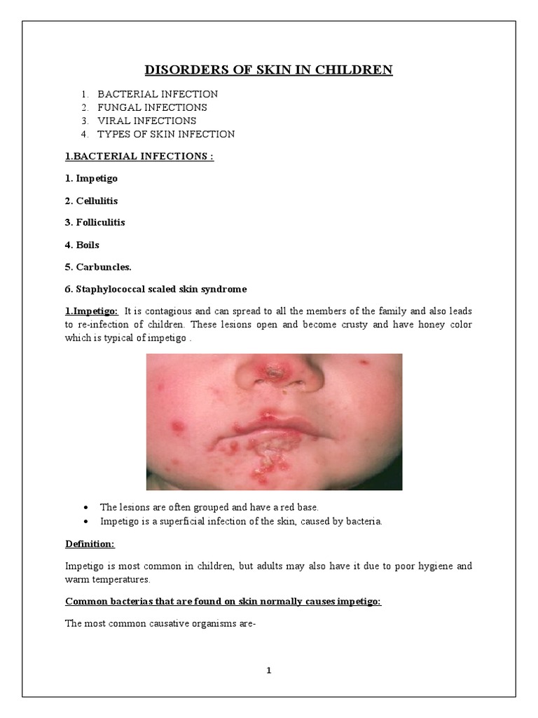 Disorders of Skin in Children | PDF | Glaucoma | Candidiasis