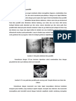 Ileus Paralitik