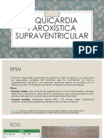 Taquicardia Paroxística Supraventricular