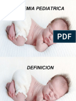 Leucemia Aguda Pediatrica