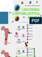 Leucemia Linfoblastica Aguda PDF