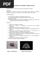 Trampa Lingual: Indicaciones y Confección PDF Odontología Ortodoncia