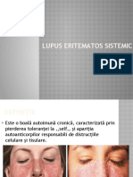 Lupus eritematos sistemic