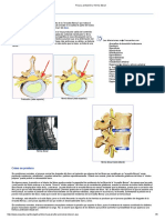 Fisura, Protusión y Hernia Discal PDF