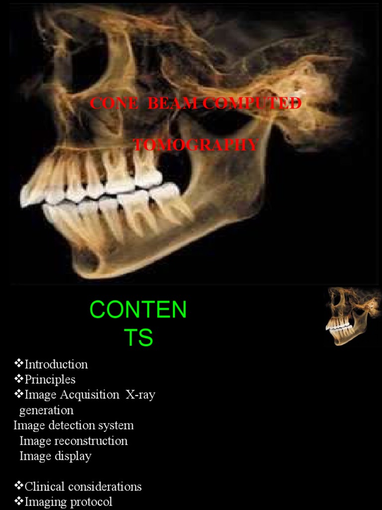 Principles of Cone Beam Computed Tomography | PDF | Ct Scan | Imaging
