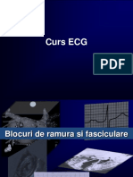 97693374-ECG-Curs-Aritmii