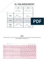 ECG LP Tulburari de Ritm - PPTX 1