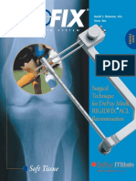 RIGIDfix SoftTissue McKernan