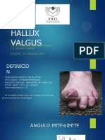 Hallux Valgus