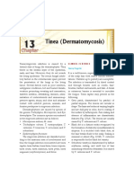  Tinea (Dermatomycosis)