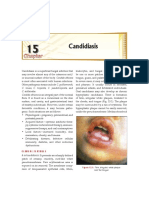 Candidiasis: A Concise Guide to Diagnosis and Treatment