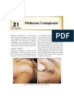 21 Molluscum Contagiosum PDF