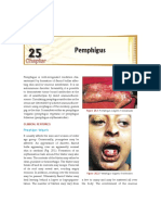 Pemphigus: Clinical Features