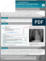 A Case Report of Primary Spontaneous Pneumothorax