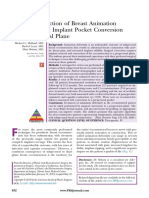 Surgical Correction of Breast Animation Deformity With Implant Pocket Conversion To A Prepectoral Plane