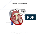 PMCC PF Support PermanentPacemakers