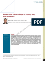 Modified Jailed Balloon Technique For Coronary Artery Bifurcation Lesions