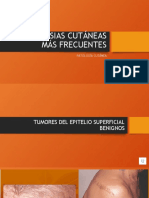 Neoplasias Cutáneas Más Frecuentes