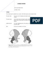 Acetabular Fractures