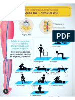 Sciatica Exercise