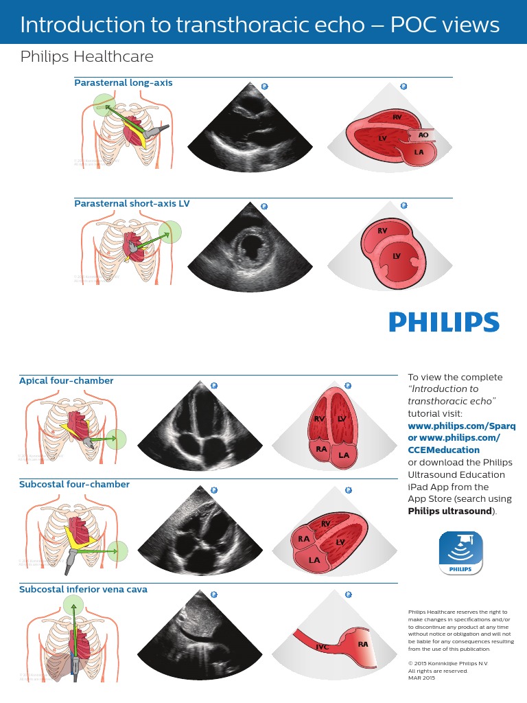 US Intro To TTE PocketCard Rev2015 HR FNL | PDF | Cardiovascular System ...