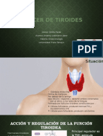 Cáncer de Tiroides 2