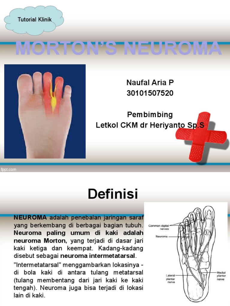 Neuroma Morton: Gejala & Penanganan | PDF