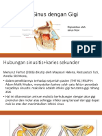 Sinusitis Maksilaris