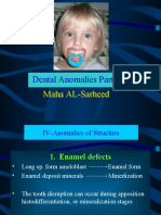 Dental Anomalies Part II: Maha AL-Sarheed
