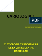 Etiología y Patogénesis de La Caries Dental Radicular