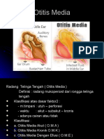 Otitis media