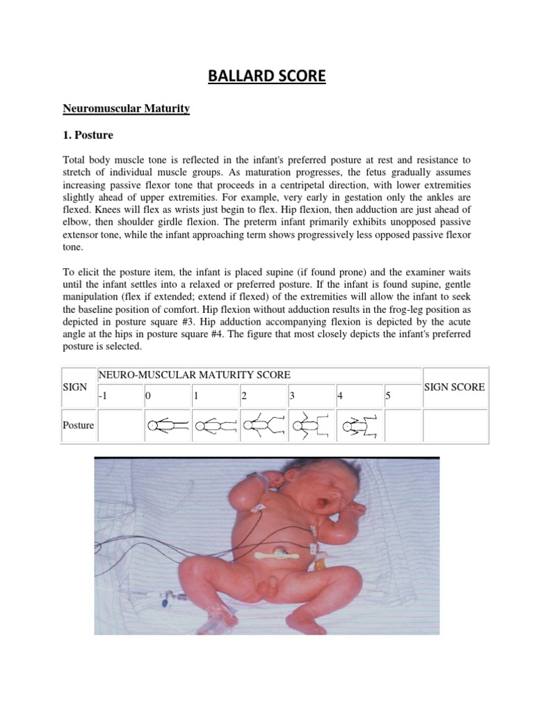 Ballard Score Neuromuscular Maturity 1. Posture PDF Anatomical