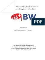 Treatment of Impacted Maxillary Central Incisor With Removable Appliance: A Case Report