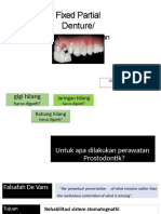 Fixed Partial Denture/: Gigi Tiruan Jembatan