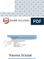 Trauma Oclusal.pptx