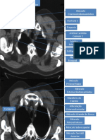 Anatomia Radiológica TORAX.pdf