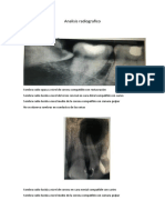 Analisis Radiografico