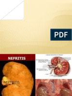 albuminuria dan neftritis