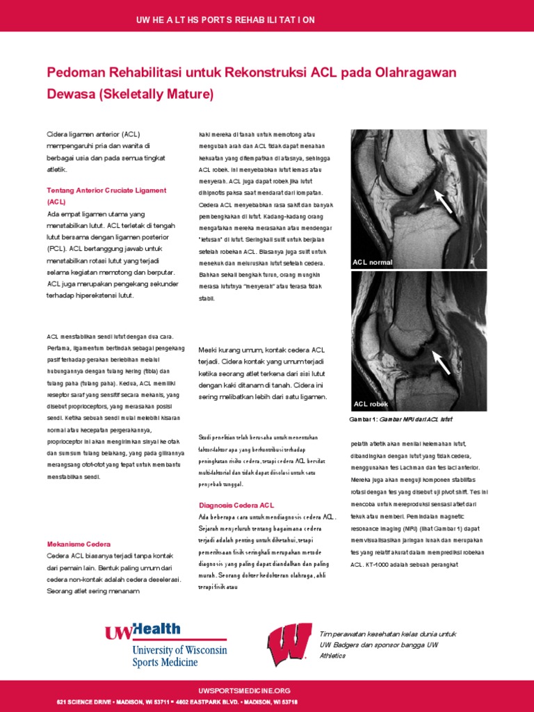 ACL en Id | PDF