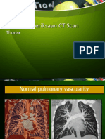 Aplikasi Klinis CT Scan Thorax