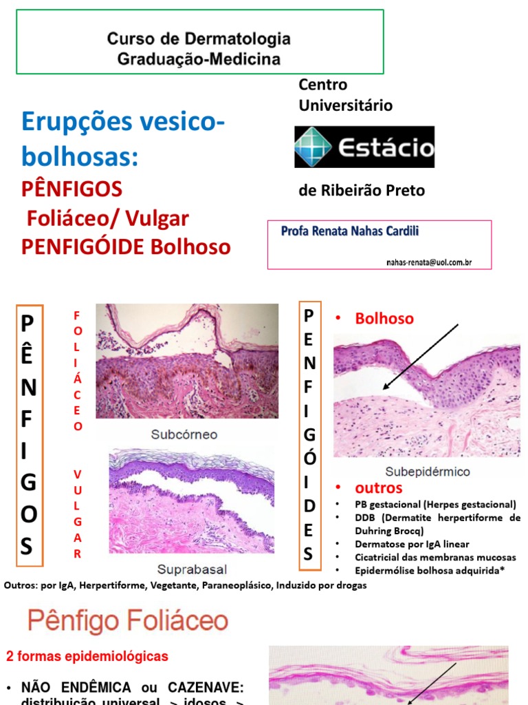 erup-es-vesicobolhosas-p-nfigos-e-penfigoide-pdf-sistema