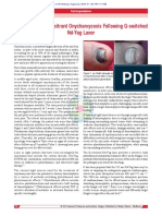 Clearance of Recalcitrant Onychomycosis Following Q-Switched NdYAG Laser, Editorial Jcutanaesth 2018