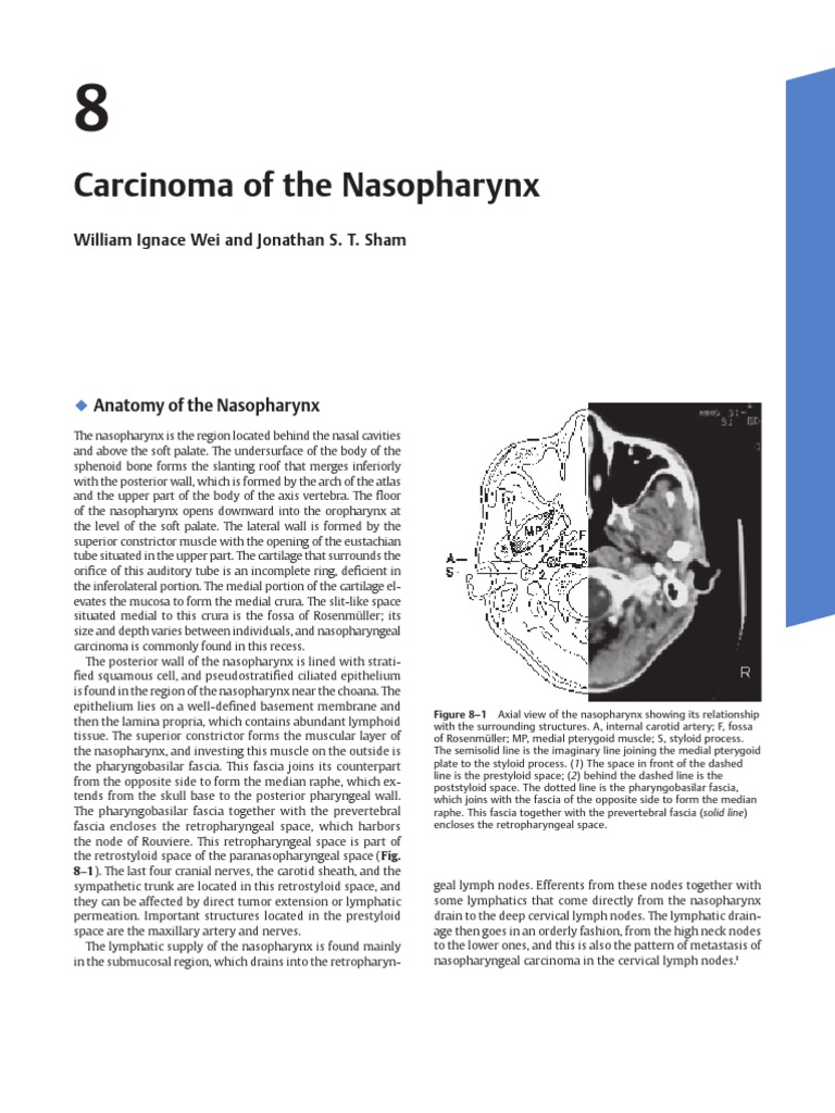 Carcinoma of Nasopharynx | PDF | Radiation Therapy | Metastasis