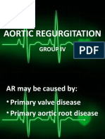 Aortic Regurgitation: Group Iv