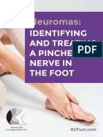 Neuromas:: Identifying and Treating A Pinched Nerve in The Foot