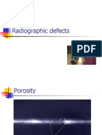 Radiographic defects